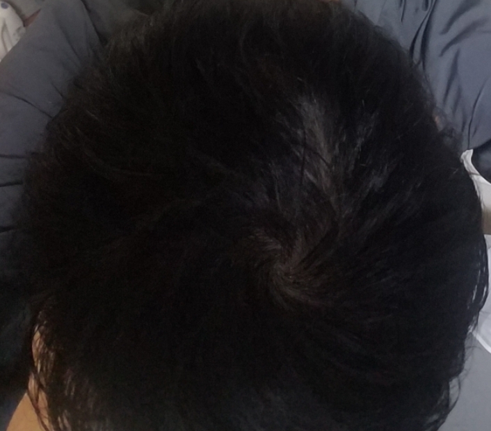 頭頂部の写真